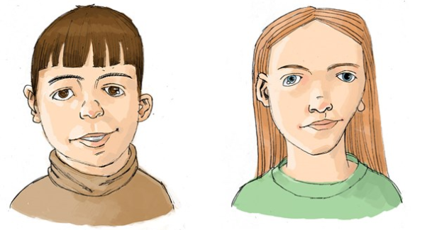 Facial asymmetry